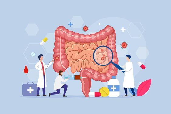 Colitis: Symptoms, What it Is, Types and Treatment